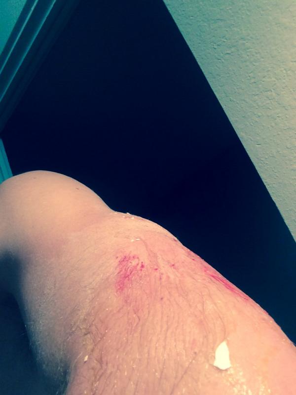 moorething1's tweet photo. Never thought getting eggs thrown and you would hurt that bad #goodyou #luhockey #goodcause http://t.co/9kkO63KesX