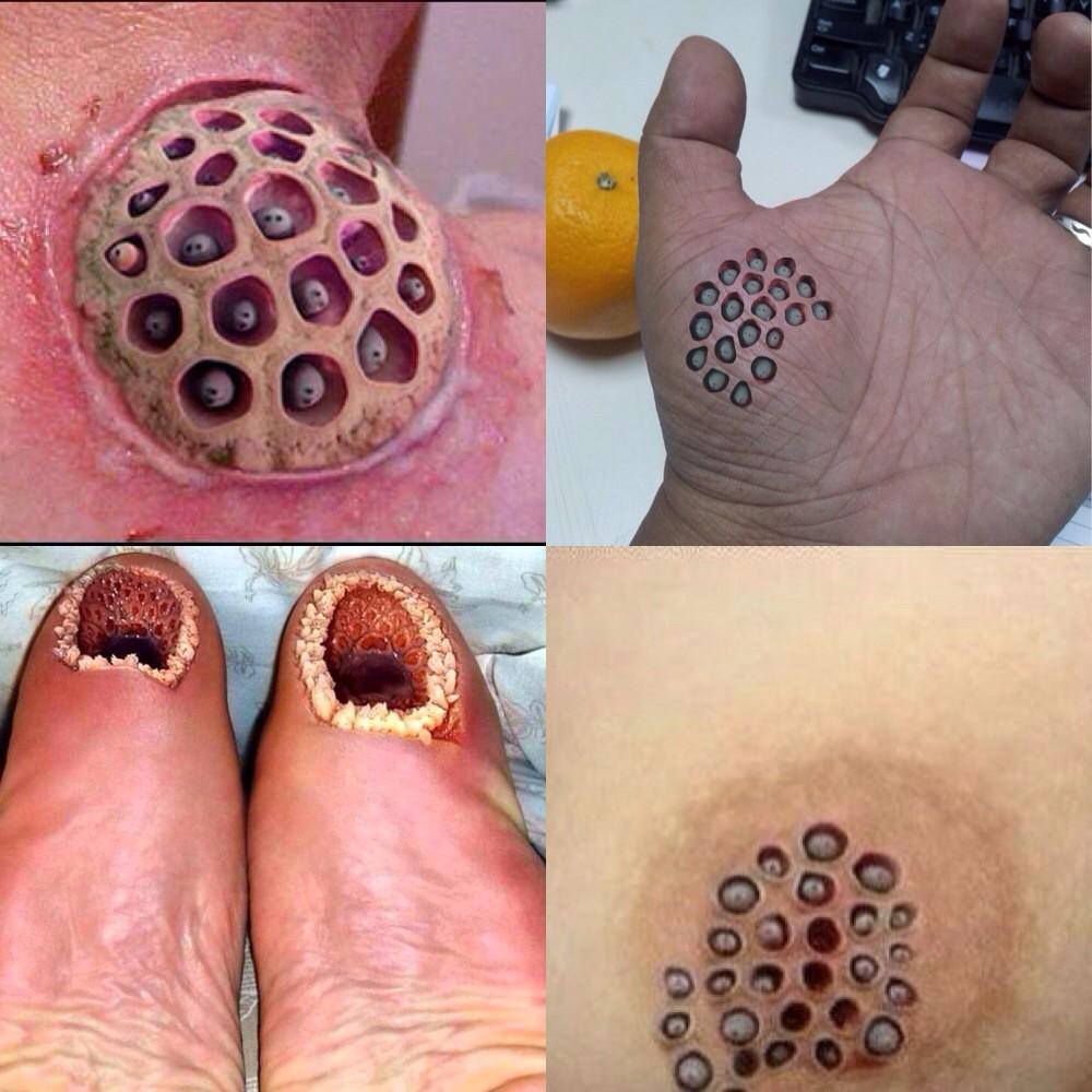 SAM в X: „Positive to TRYPOPHOBIA test. #creepyshit http://t.co/G8QOE6zZPn“  / X, image size:1000x1000
