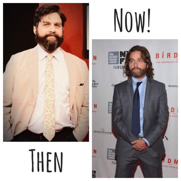 CelebMoviePics's tweet photo. Impressed with Zach Galifianakis' weight loss? http://t.co/18WIg7cABx