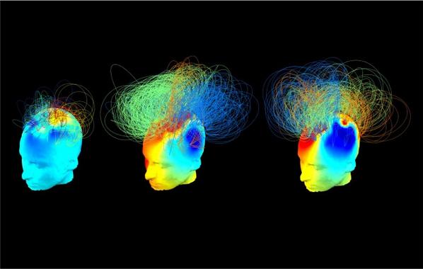 WIRED's tweet photo. New algorithms search for signs of consciousness in brain injury patients http://t.co/csBRsXeFMi http://t.co/xa70yV1Xrv