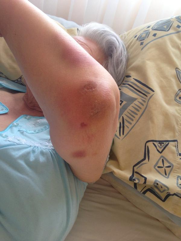 Dos noches en #HospitalFricke y mi tía abuela de 89 años vuelve en este estado. Cómo podríamos saber qué sucedió?