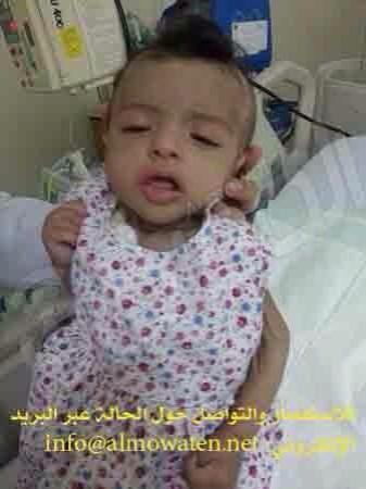 saudistuff's tweet photo. #حالة_إنسانية

“ريتال” تعاني جفاف مزمن ، تسبب في إنقاص وزنها وتراجع حالتها الصحية تحتاج إلى مستشفى متخصص لعلاجها http://t.co/6hjS51ndwF