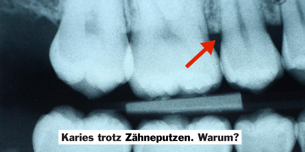 Mhplus Krankenkasse Zahnbursten Reinigen Nur 60 Der Zahnflachen Deshalb Zahnreinigung Http T Co Guxj58kwvo Offenfursleben Http T Co Cfnmigxhlr