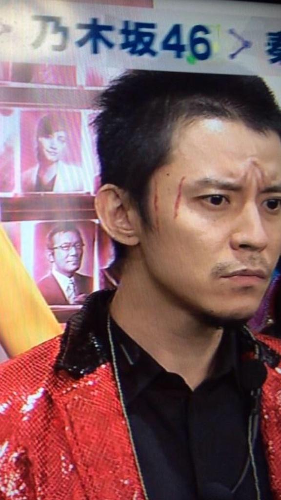 趣味専用垢 Na Tviteru 渋谷すばるの傷について情報求む メイクだよね きっと 関ジャニ Mステ Http T Co Sqwfwwrhid 趣味専用垢 Na Tviteru 渋谷すばるの傷について情報求む メイクだよね きっと 関ジャニ Mステ Http T Co Sqwfwwrhid