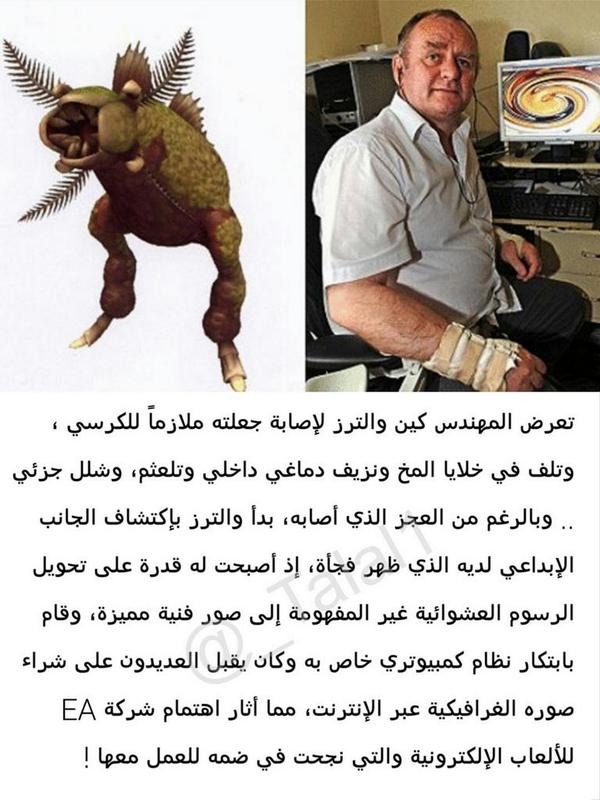 Talal1's tweet photo. حوادث وإعاقات حوّلت أشخاص لمبدعين ! http://t.co/o1glUnhrKm