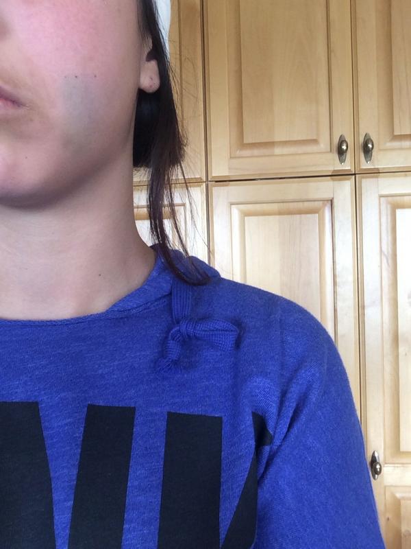 bin_dropped's tweet photo. My new blush matches my hoodie😔
#brusing #pain #wisdomteeth http://t.co/eXfwUpMxFz