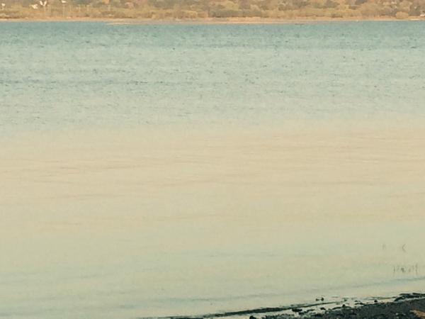 RuggieroRichard's tweet image. Chilling been cleared more surgery Tuesday on my knee/leg hopefully last one.