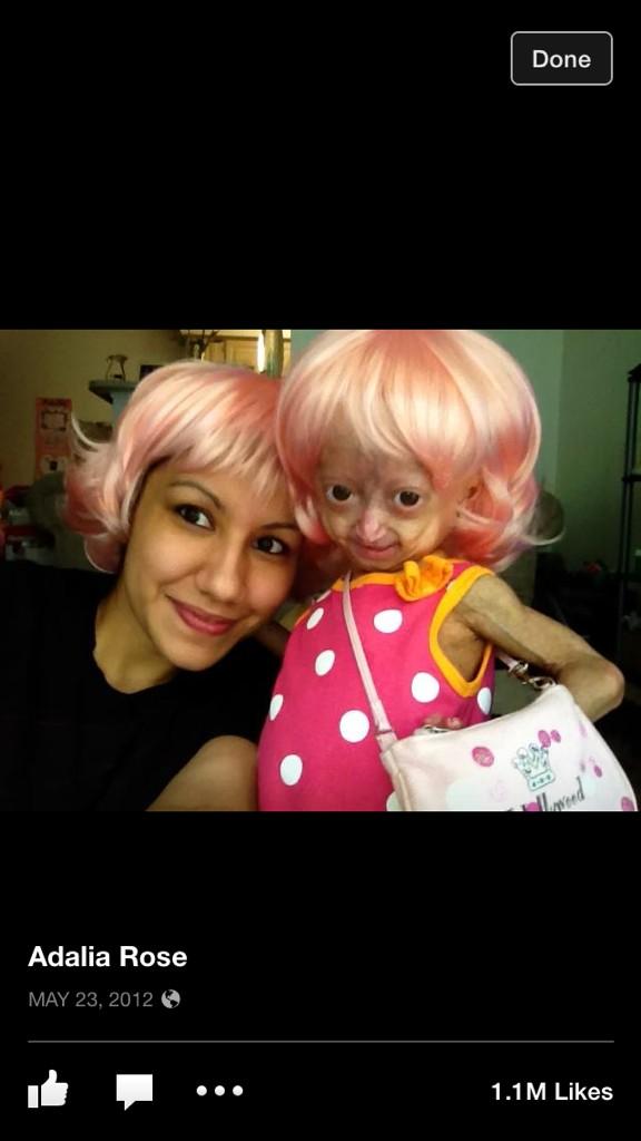 alleysunjune's tweet photo. Use http://t.co/s5T4wuUZcx as search engine, pick Progeria as the cause & 1 penny donated to PRF per search #PRFpenny http://t.co/vviLhAR3JX