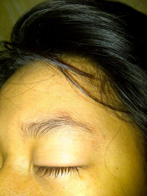 Bengkak kan? Kebanyakan nanGis sih !