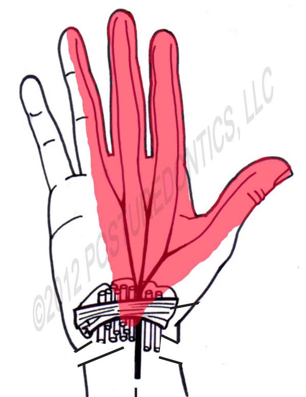 Posturedontics's tweet photo. Is it really Carpal Tunnel Syndrome or a mimicking syndrome.  Find out more: http://t.co/SIC3mzyPHV http://t.co/YzKqIb08i6