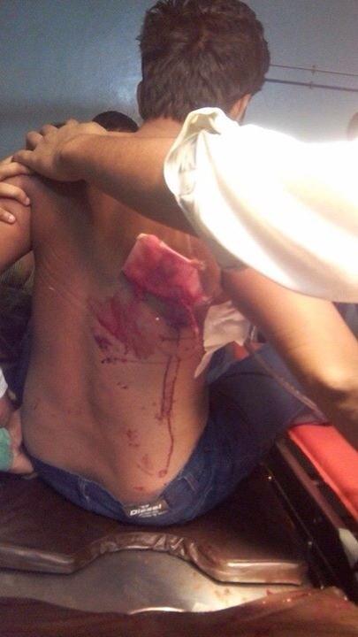 faibyy's tweet photo. Humdard of #MQM Ashfaq injured by Police Firing at Islamabad Chowk #Hyderabad @abidifactor @WasayJalil @KaleemAltafi http://t.co/m2xsvGld8k