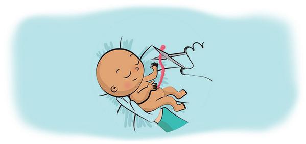 canannecom's tweet photo. EpiduralAnestezi (ağrısız doğum) hakkında bilinmesi gerekenleri sizler için derledik.  http://t.co/eZymHJq2fN http://t.co/16aeuLJQBc