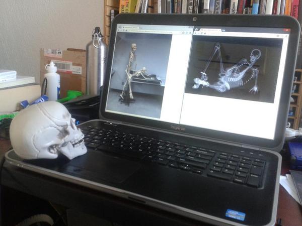 a___ayala's tweet image. HOY ES DIECINUEVE DE OCTUBRE Y SE SOLUCIONÓ MI ESQUELÉTICO PROBLEMA TEMPORALMENTE... IGNORO CÓMO. #SpookyChallenge