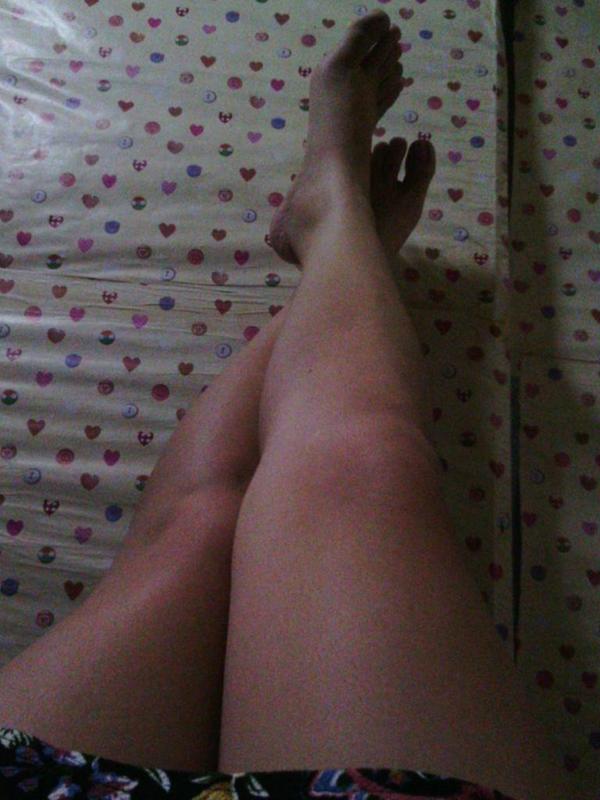 aprillmaganda's tweet image. Current position #pain #lowerextremities 😑😌