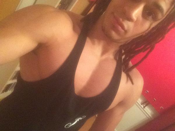 0ptimistic_soul's tweet photo. Battered chest tonight reppin that #Flex13 http://t.co/LUrhlAKh1n