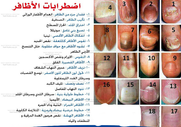 kUWAITIC tweet media