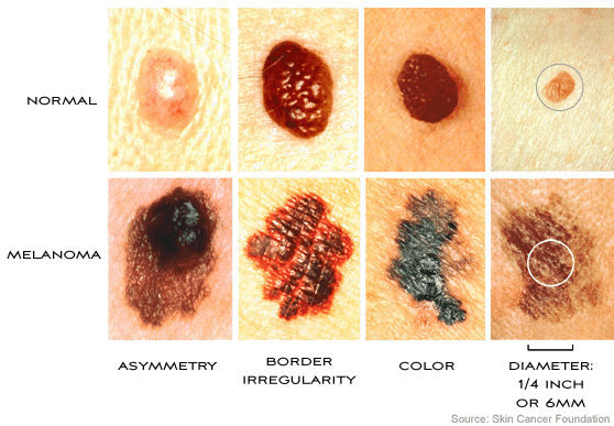 Related image