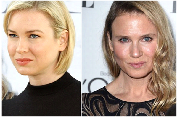 Where Are They Now Renee Zellweger 45 Bridget Jones Barely Recognisable Been On Hiatus Since 10 Back Acting With A Film Tbr 15 Http T Co Pppna5slkz Twitter