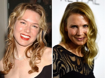 تويتر Buzzfeed على تويتر This Is What Renee Zellweger Looks Like Now Http T Co Yz3jlsxe8i Http T Co Thw4zygsbv