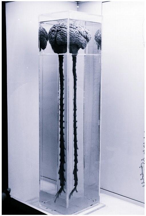 TerrifyingPics's tweet photo. Human brain and spinal cord http://t.co/tAJqUf0D02
