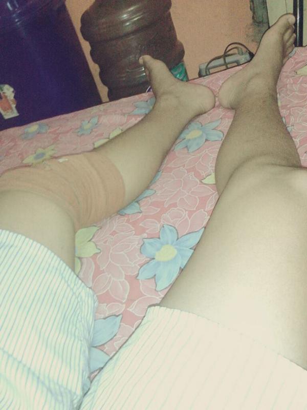 Geokitingg's tweet photo. Musibah pun menimpa gua :'( Sakittttt :( http://t.co/a9WF5UiZ3w