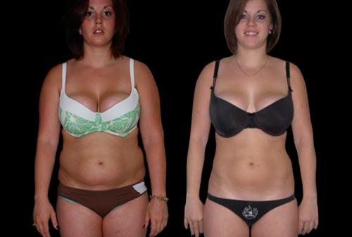 The Flex Belt on X: Looking amazing! Today's Flex Belt Before and After  photo.  / X