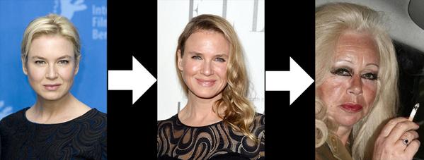 Благодаря инновационным технологиям смоделировал как будет выглядеть Рене Зельвегер, если продолжит делать пластику.