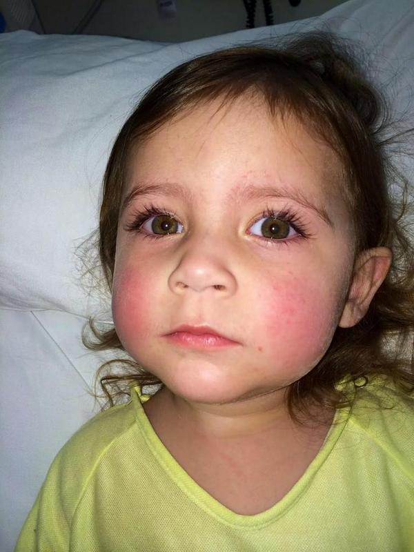 #MastCellMomma - Addie's Story...and Dustin, &amp; Brandon, &amp; Mikayla"We are a Mast Cell FAMILY!"
mastcellmomma.blogspot.com/2014/10/mast-c…