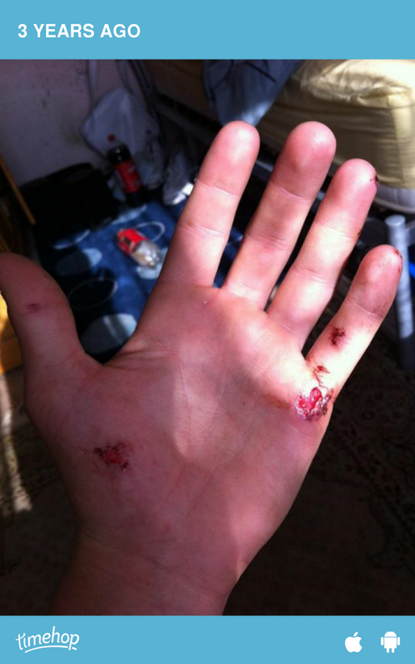 broughton_jack's tweet photo. This hurt so much :( http://t.co/dgCSVs9kqX http://t.co/fCydPJN72f