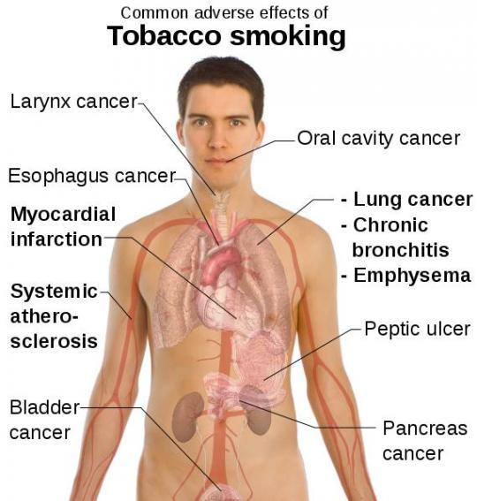 mattlogical's tweet photo. What did Big Tobacco do after being caught making a deadly product? Unbelievable true story. http://t.co/PI2fpBNnT0 http://t.co/fdtdorZfRY