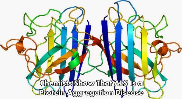 Christopher Maricle (@chrismaricle) on Twitter photo “<a href="/neuro400/">WheatonNeuro</a> : Chemists Show That ALS Is a Protein Aggregation Disease neurosciencenews.com/sod1-als-genet… #neuroscience ” “<a href="/neuro400/">WheatonNeuro</a> : Chemists Show That ALS Is a Protein Aggregation Disease neurosciencenews.com/sod1-als-genet… #neuroscience ”