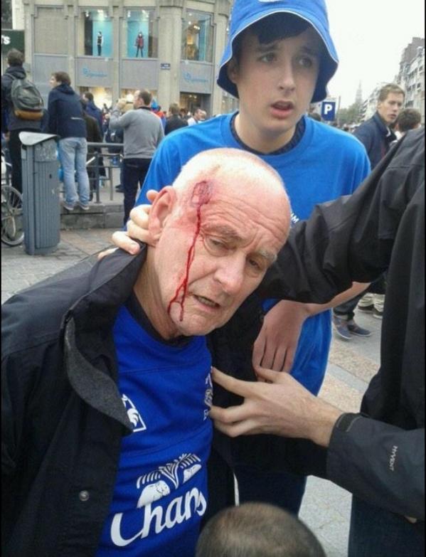 sportlifefr's tweet photo. Hier, les #CRS se sont attaqués aux supporters d'Everton les plus dangereux à #Lille #LOSCEFC #EVERTON #honte http://t.co/muiPWc5UrH