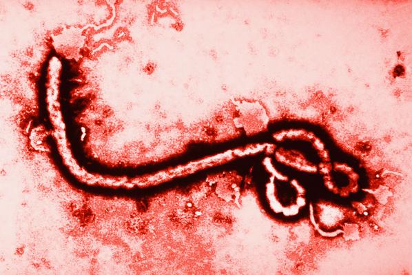 NHSuk's tweet photo. #Ebola - our detailed guide to symptoms, treatment, and risk factors here: http://t.co/s9269iO8N2 http://t.co/JZPpk4kk2q