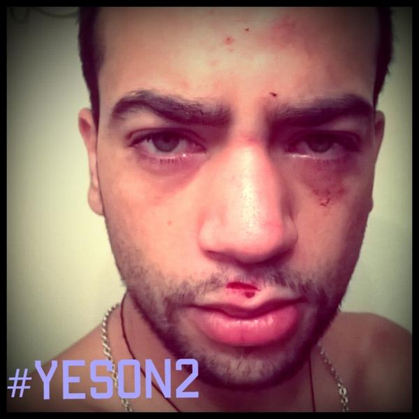 NE_Thing_4Guap's tweet photo. Legalize it! At least for the people who suffer like me. I know I'm tired of hospitals #Epilepsy #YesOn2 #FLpotdebate http://t.co/EDW8uURDcR