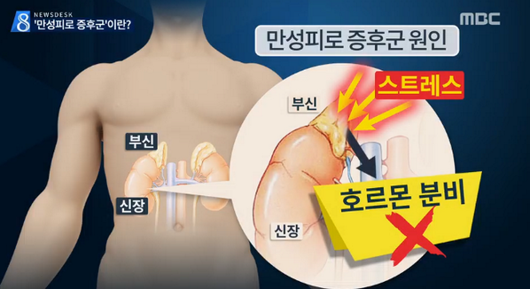 mbcnews's tweet photo. [뉴스데스크-잘 쉬어도 안 풀리는 '만성피로'…이겨내려면 이렇게] 피로감이 6개월이상 지속되면 '만성피로'라 할 수 있어. 하루 30분이상 유산소운동 해 주는 것이 좋아.http://t.co/FbhNWQ4R8G http://t.co/yNHZihKd7J