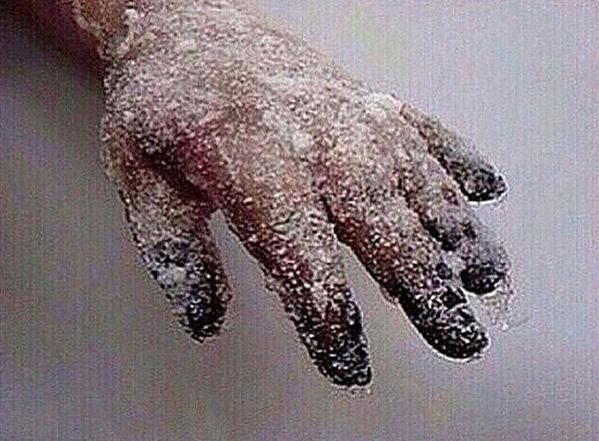 when u accidentally touch ur heart.