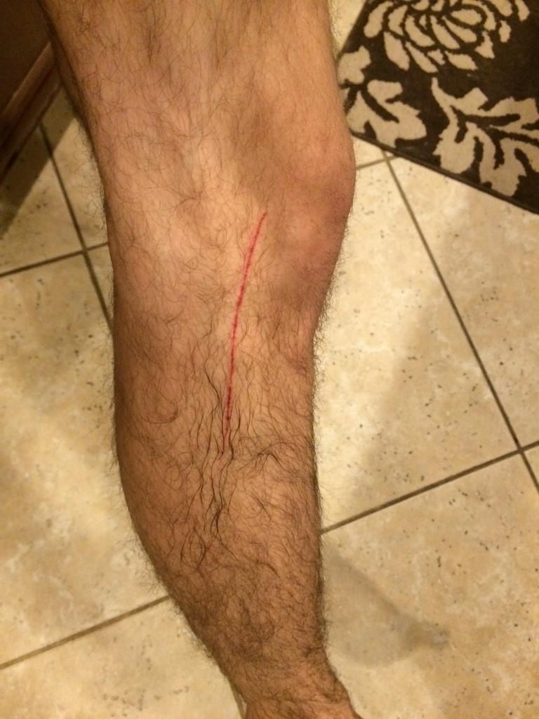 brendangibson94's tweet image. #poolboyproblems