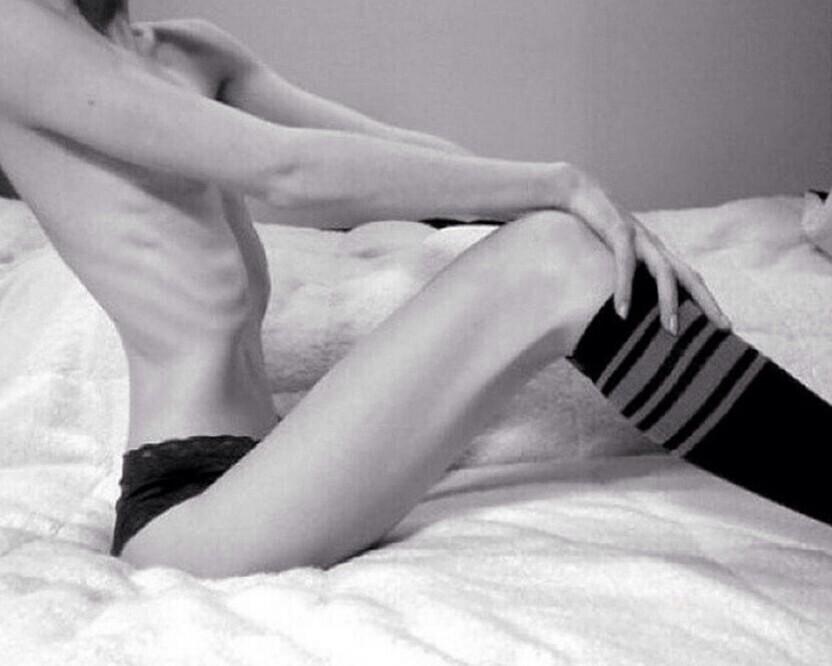 Kiss_0f_Death_'s tweet image. #thinspo #ribs #ribbones #spine
