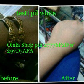 Kamu cari PIL PEMUTIH RACIKAN KLINIK yg AMPUH tnp Efek Samping?? Invite aja OLALA SHOP. Pin 27776F2D / 297D7AFA