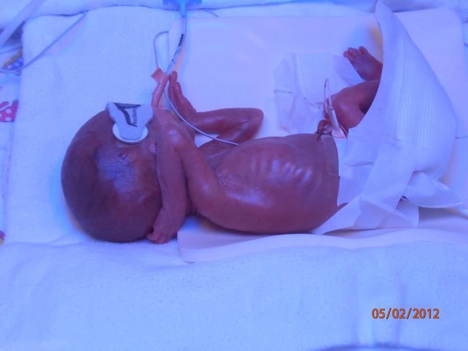 #worldprematurityday is fast approaching #nov17 #myhero #prembaby #sotiny #lovemyson 
#walkwwings #tinysparkswa