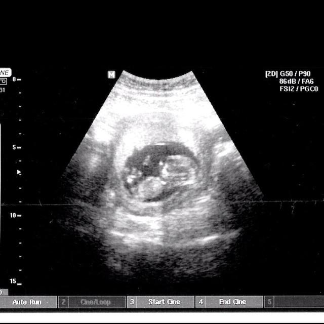 ArielMooreBR's tweet photo. A mãe da Ariel esta grávida de um menino, ou seja, Ariel terá um novo irmão! Congrats @ASKMamaMoore &amp; @havemoorefun 💖 http://t.co/xECM1eOlAd