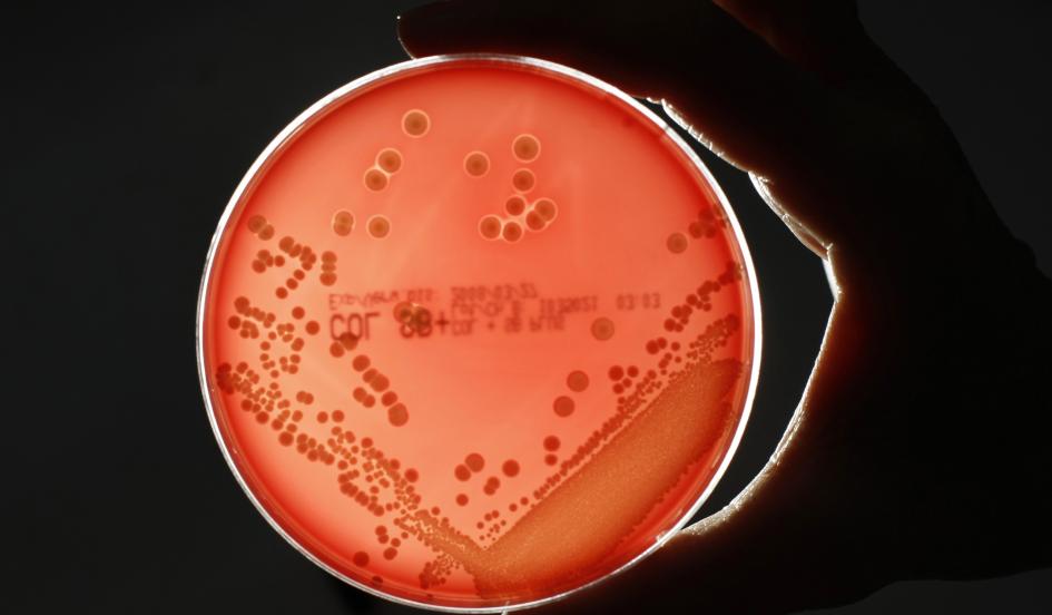 Revolutionary new antibiotic alternative could save the world from superbug "apocalypse" — bit.ly/1y9FYT1