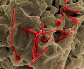 ADeebees's tweet image. How Ebola Blindsides the Body's Defenses - Scientific American scientificamerican.com/article/how-eb… 

#Ebola