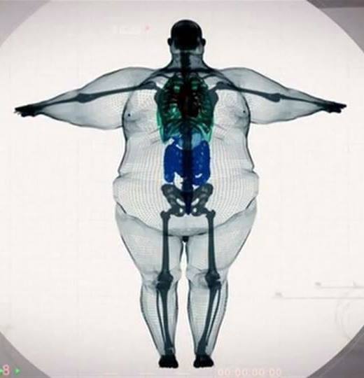 Nobody is big-boned. Please take care of yourselves