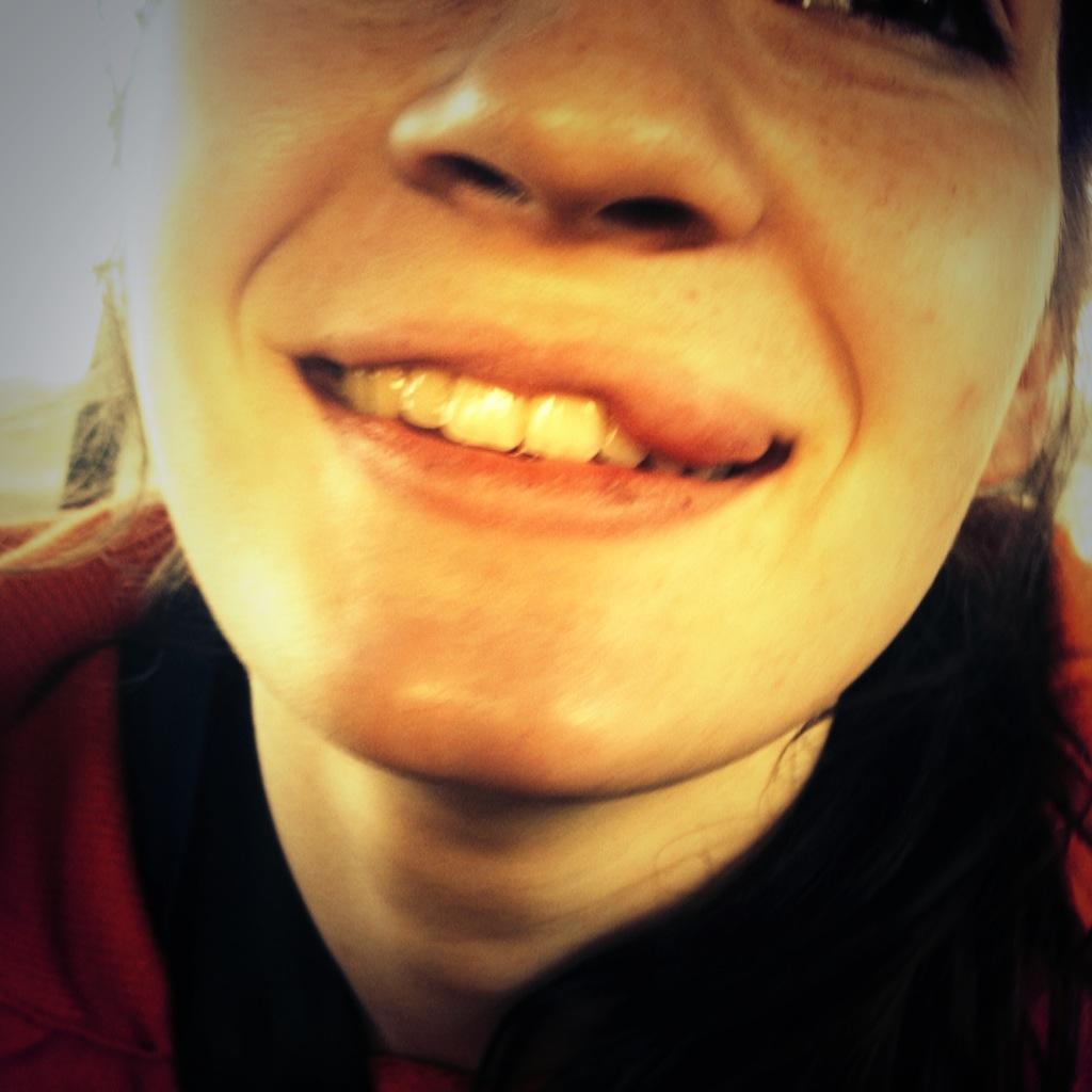 elaineedoylee's tweet photo. If u think ur havin a bad day.. Think again 👄 #pray4shelly #datlip #KylieJenner http://t.co/nw6Q0Vm2TB