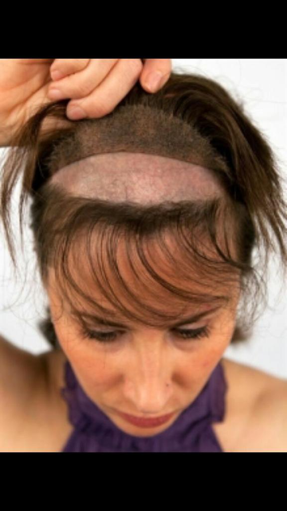 01208274340 قبل شراء باروكة اتفرج علي الفيديو ده - YouTube