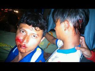 CC <a href="/simamaung/">SIMAMAUNG SPORT</a>     "<a href="/AkbarRahardi/">MD</a>: Bakal keneh teu dendam mun keiu.? "<a href="/BobotohID/">BobotohID</a>: <a href="/Naufalafh/">Naufal Aflah Herdanto</a> "