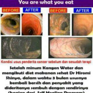 ndaary's tweet photo. @juliaperrez coba minum Kangen Water ya... Ikhtiar sllu mnt tlg ke Alloh yaa.. http://t.co/hZcsoqDebG