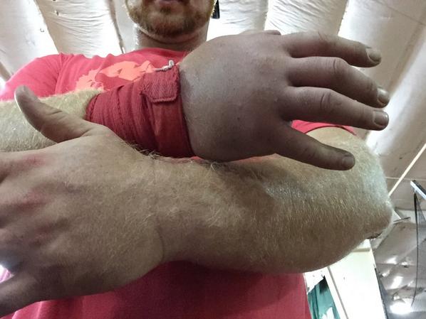 ZigZagGiant's tweet image. “@kurt_roberts70: First day of drills with a shot. #throwersproblems #ShotPut http://t.co/ftVUgae9RZ” @B_Robbins21 @bethhhxoxo this is me.