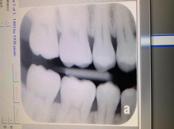 Limpieza y revisión dental, check! Gracias <a href="/KCJoyeria/">Karla Castillo S</a>